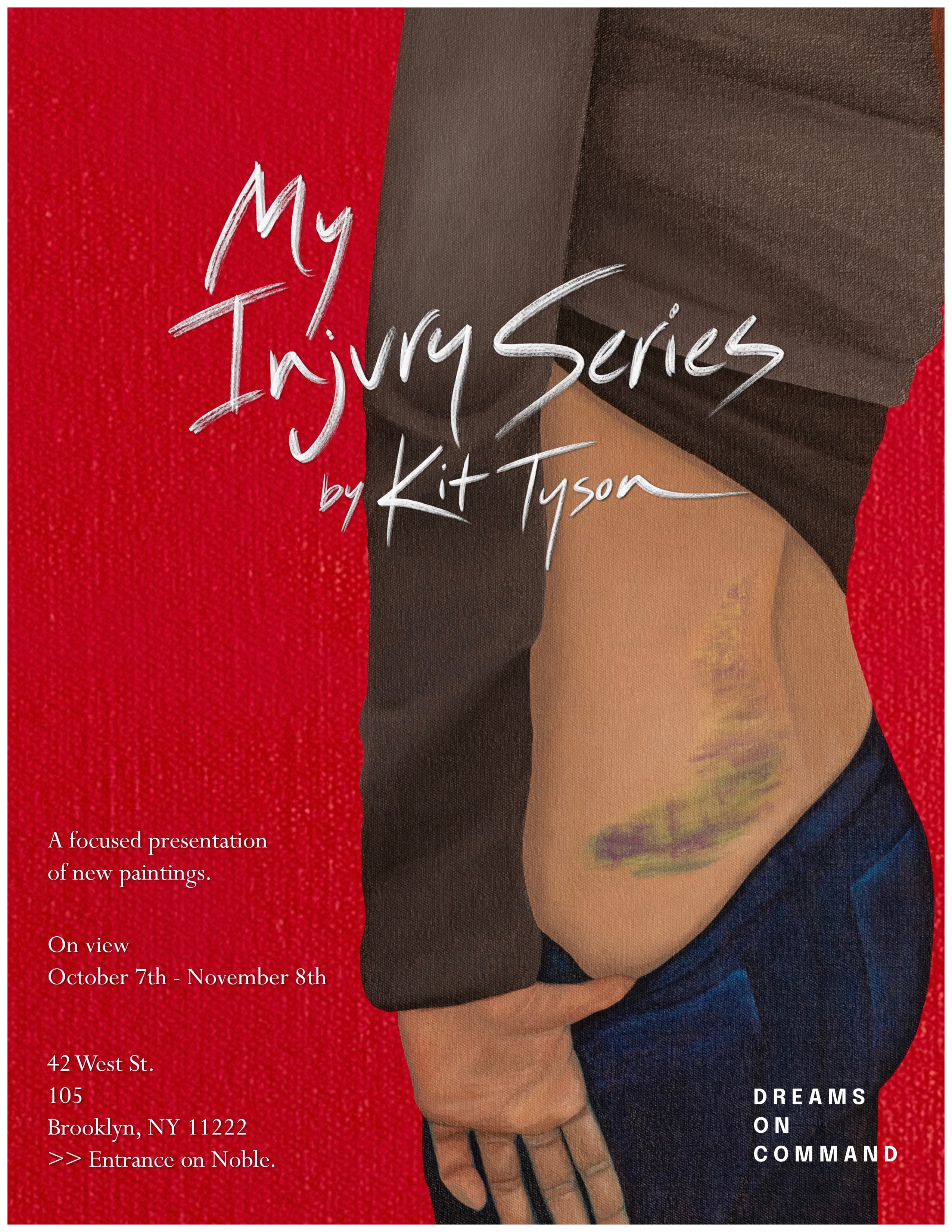 KIt Tyson's "Injury Series" On View 