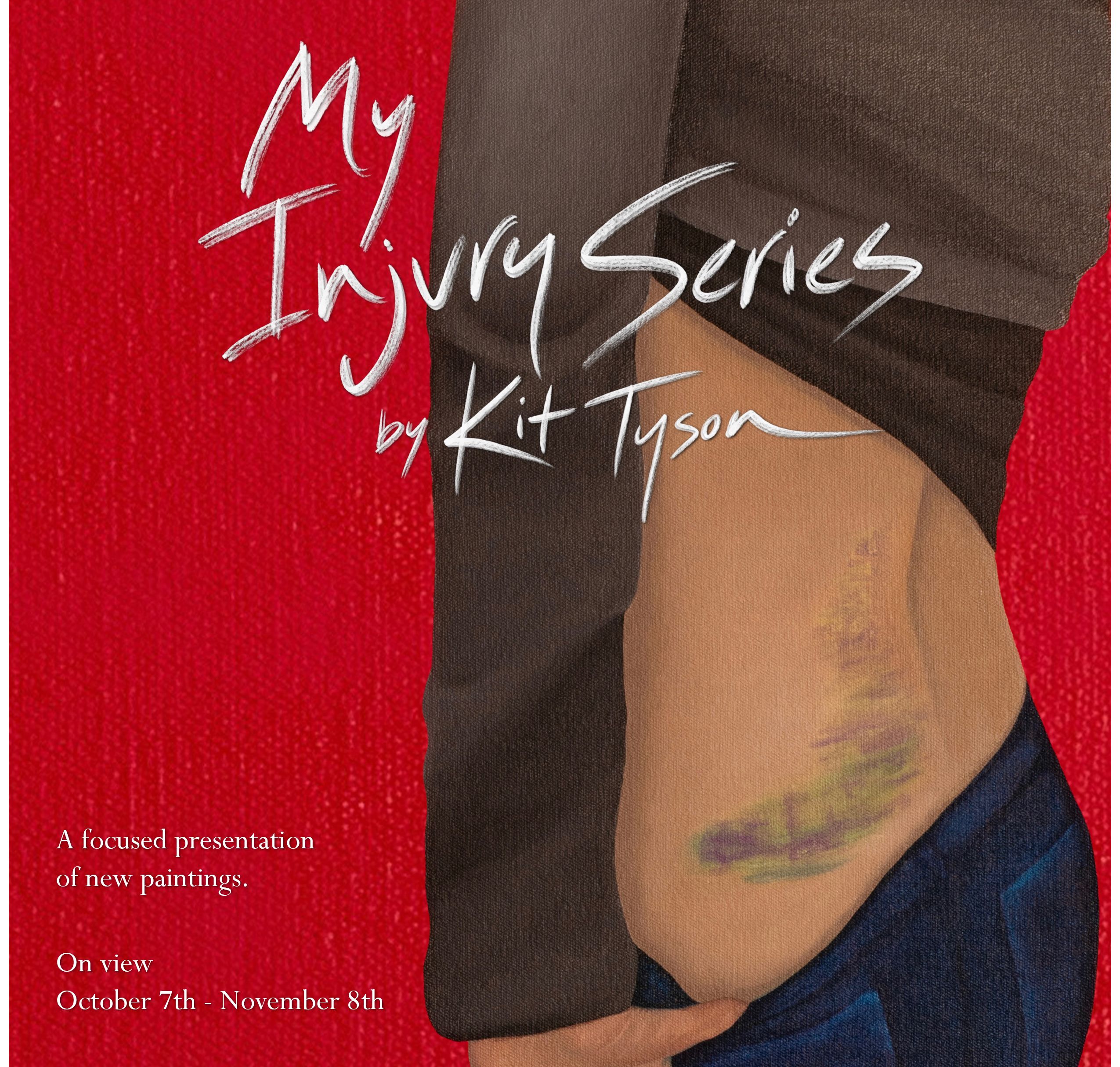 My Injury Series october 6th